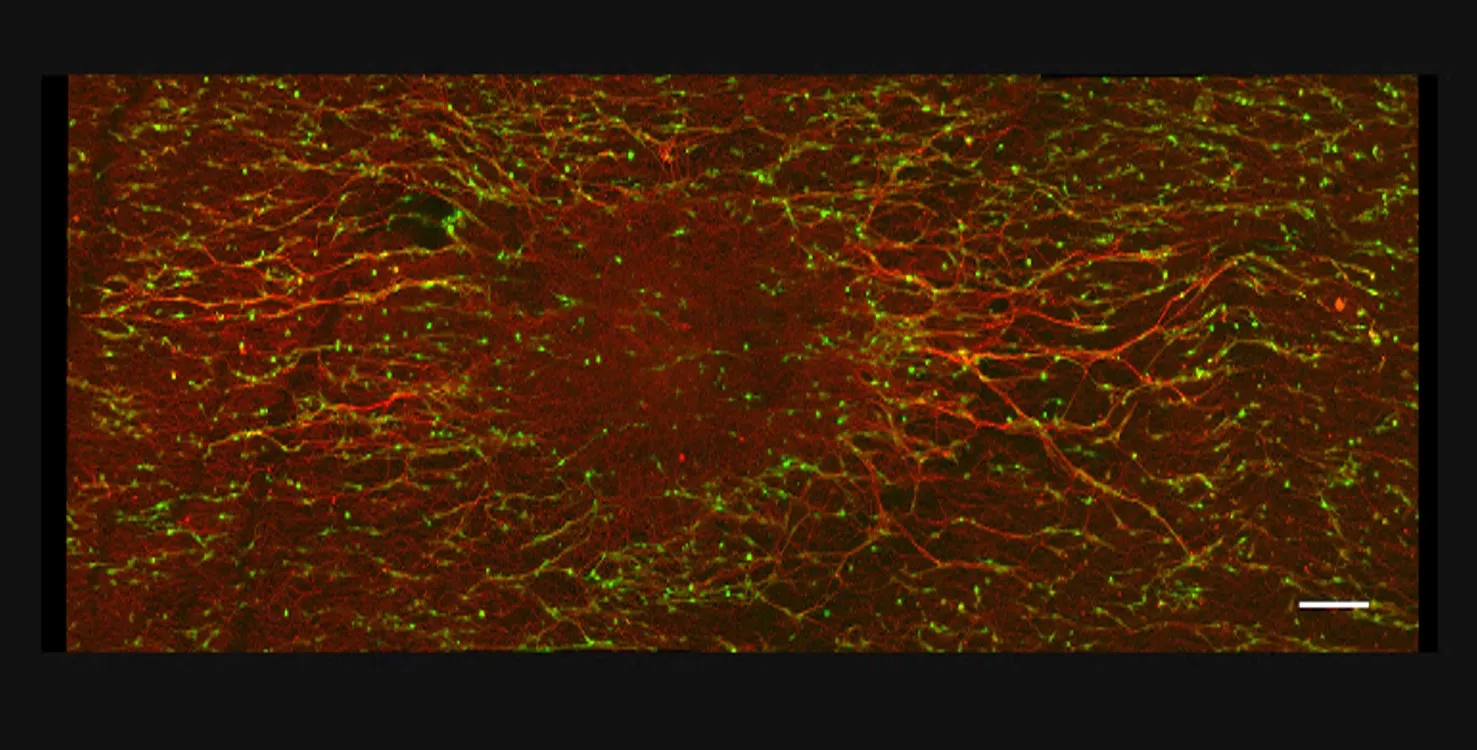 Image of growth of axons