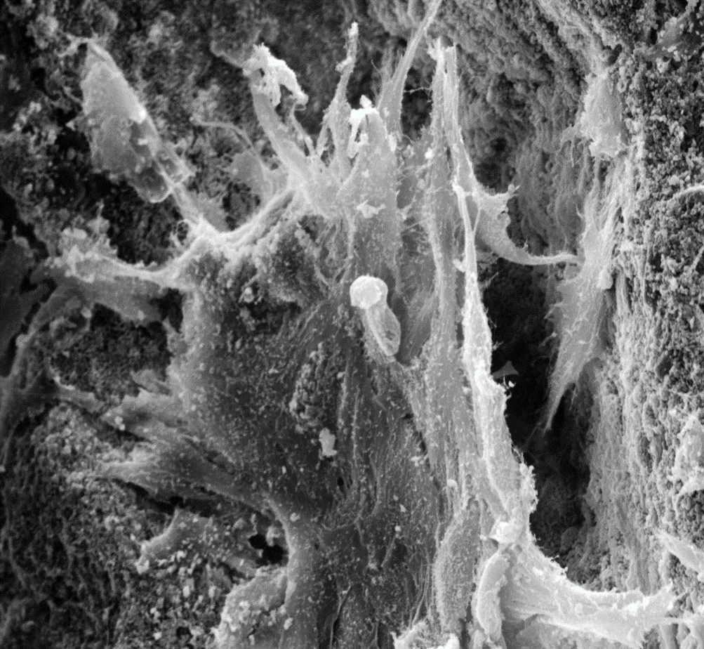 Research Projects | TISSUE ENGINEERING AND ACTIVE BIOMATERIALS (TEAM ...
